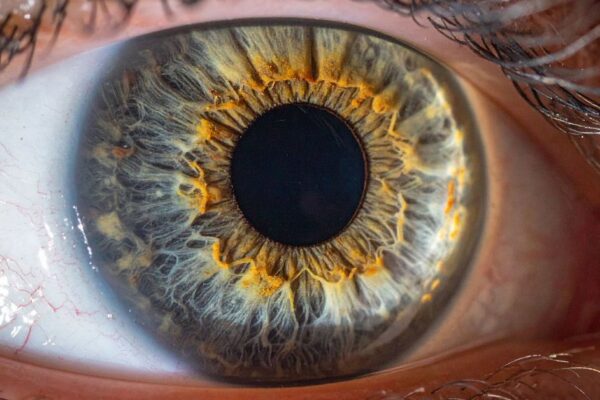 How Corneal Thickness Influences Your Vision Correction Options featured image