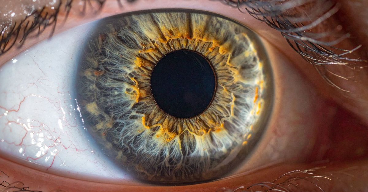 How Corneal Thickness Influences Your Vision Correction Options thumbnail